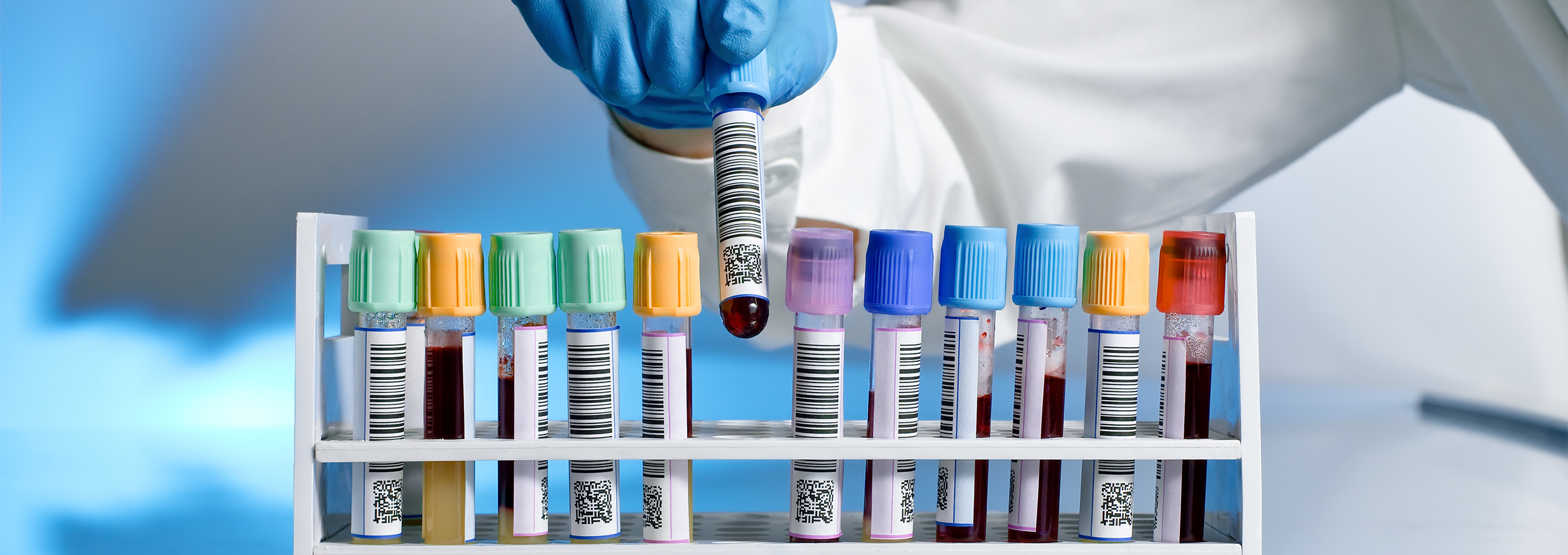 Lab tech, putting vial filled with blood into container with other vials of blood.