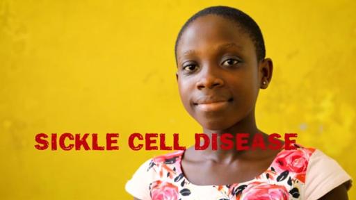 Play the Sickle Cell Public Service Announcement Video.