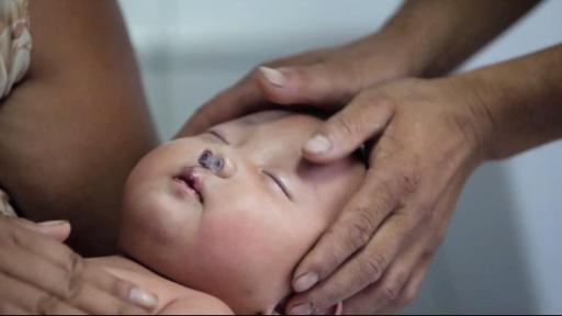 Child recovering from surgery, head in fathers hands.