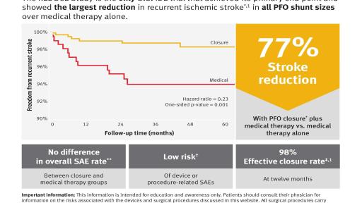 Gore REDUCE Clinical Study flyer