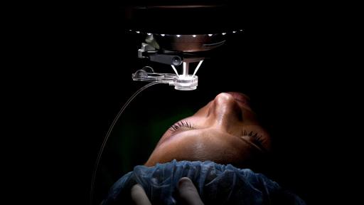 Patient under Femto Laser