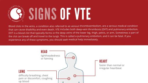 Signs of VTE