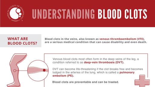 Understanding  Blood Clots