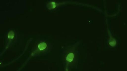 Fluorescent microscopy distinguishes fertile from infertile sperm cells by their green glow.