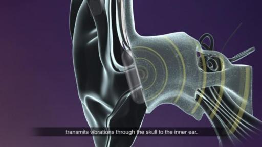 Play video: How It Works