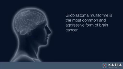 Play Video: GDC-0084 and Glioblastoma Multiforme