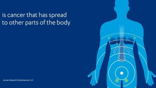 Metastatic castration-sensitive prostate cancer