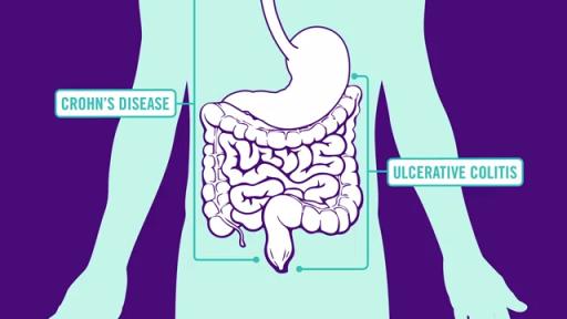 Play Video: Stelara MOA