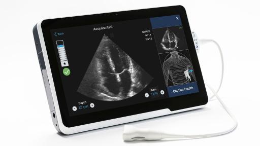AI is the world&rsquo;s first AI-guided ultrasound software, which is embedded onto a compatible
ultrasound system to help users acquire and interpret ultrasound images with confidence.