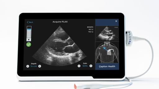 The Caption AI user interface features a Quality Meter on the left, which fills as the user approaches
the optimal view, turning blue when the image is deemed diagnostic. The AutoCapture feature then
records the clip hands-free.