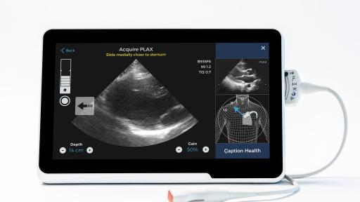 AI comes with Prescriptive Guidance, which prompts users to make specific transducer
movements to optimize their image and help them capture a diagnostic quality image. Here, the
guidance prompts the user to slide the transducer medially closer to the sternum to obtain a
diagnostic quality image.