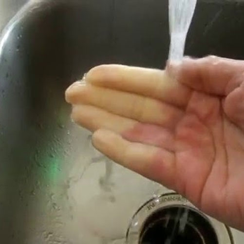 Raynaud's Phenomenon in Real Time