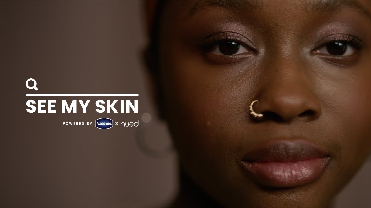 Play Video: Vaseline®