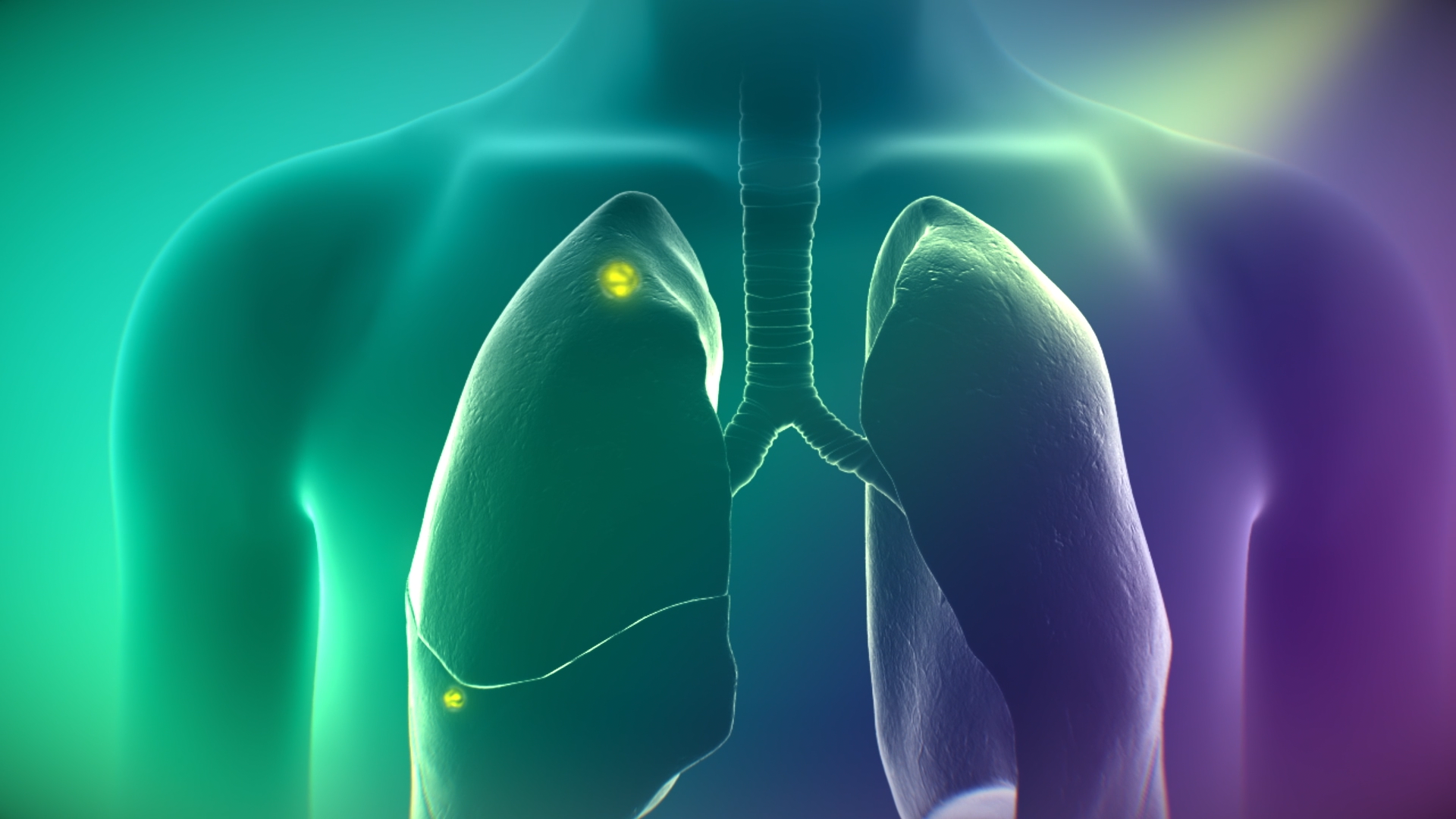 CYTALUX illuminating cancer in lungs