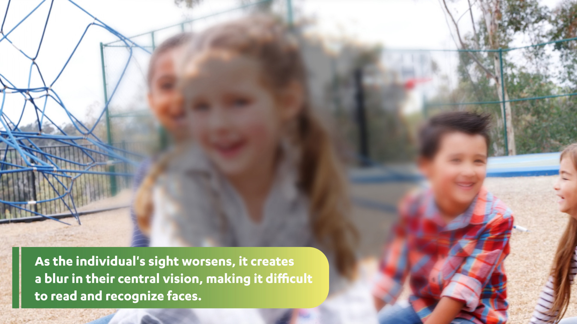 As the individual's sight worsens, it creates a blur in their central vision, making it difficult to read and recognize faces: Photo of young girl in a gray checkered shirt smiling with other children on a playground. The center of the image is blurred in gray making the girl's face difficult to see and showing the progression of central vision loss.