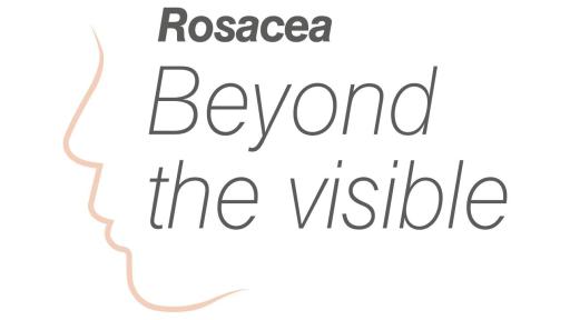 Beyond the visible logo