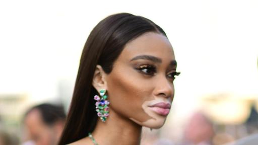Image of Winnie Harlow drinking a glass of Perrier-Jou&euml;t at AmfAR