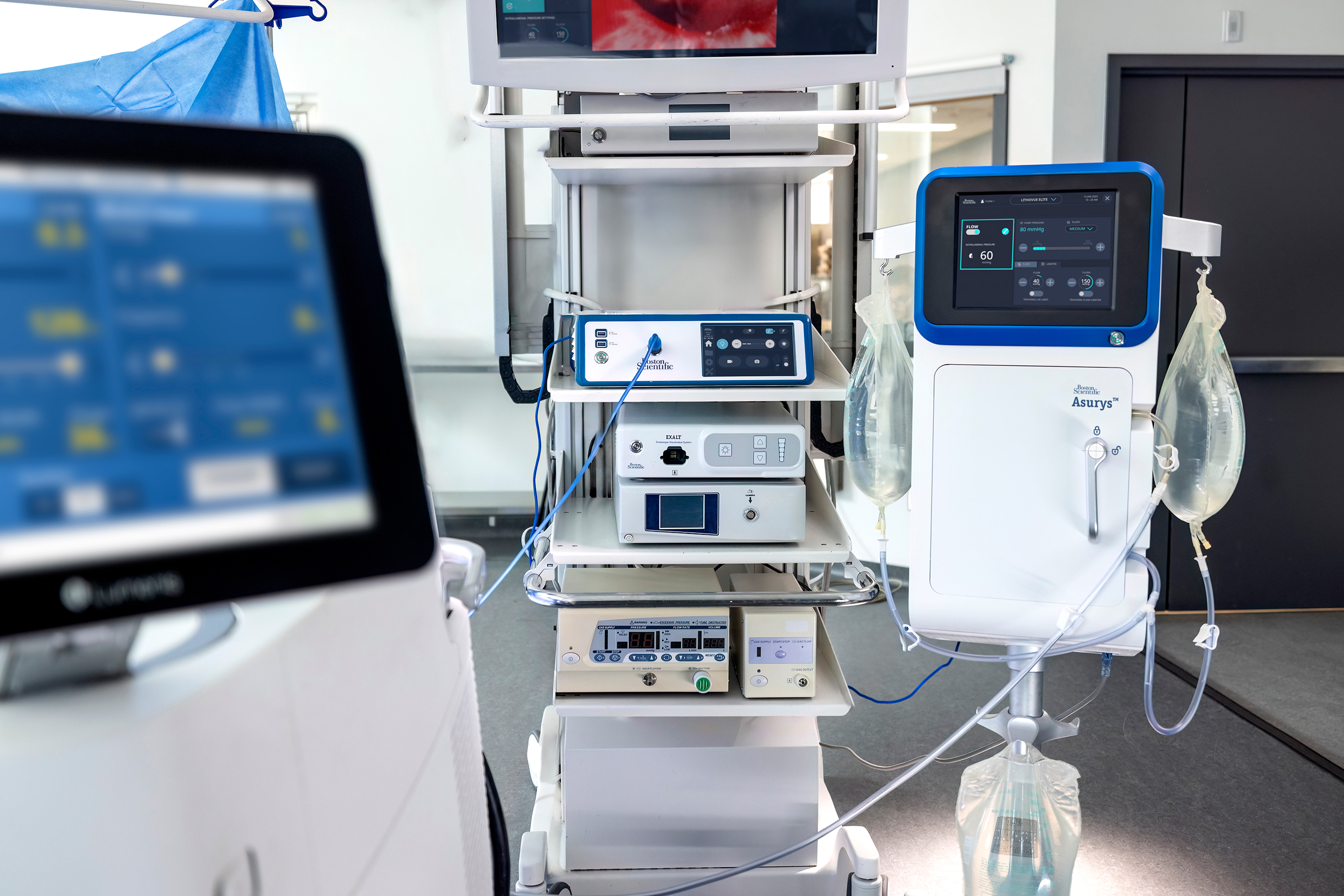 When paired with the LithoVue™ Elite Single-Use Digital Flexible Ureteroscope with IRP monitoring, the Asurys System is designed to aid in procedural IRP management, reference 11