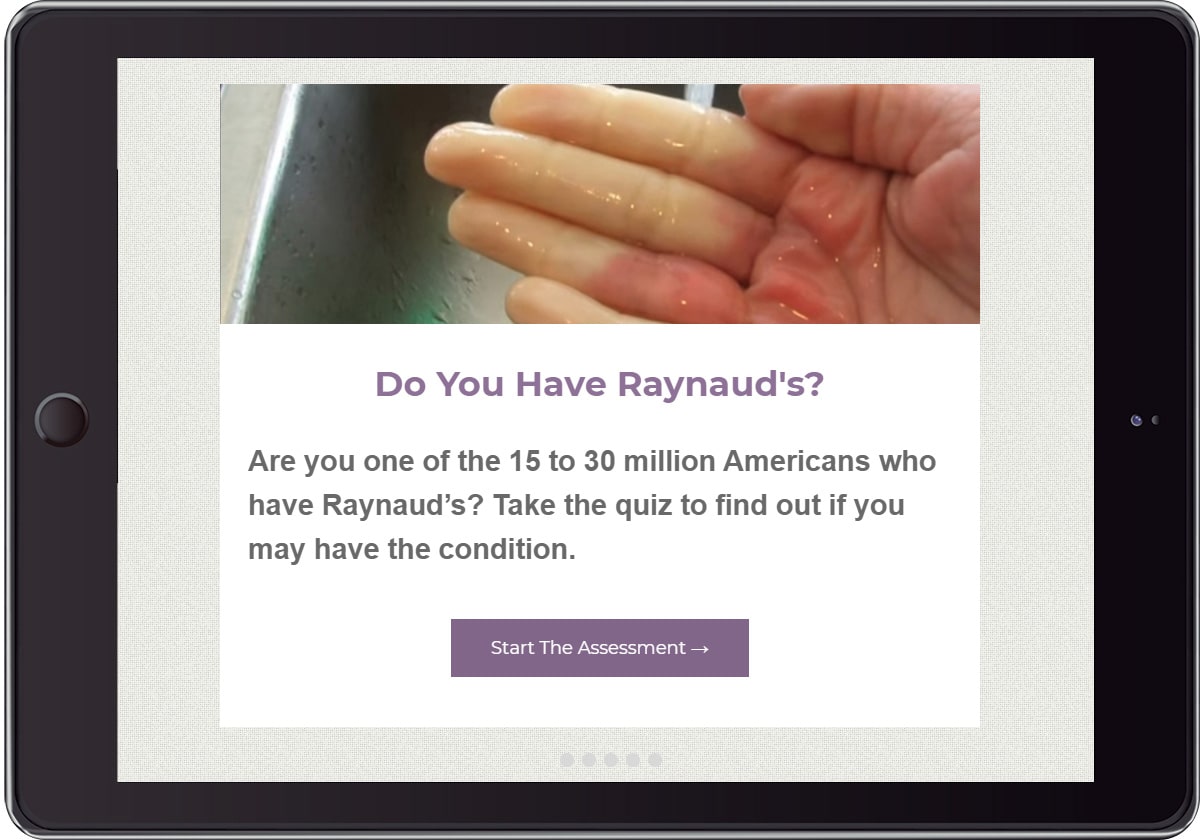 Raynaud's Association Catalyst quiz