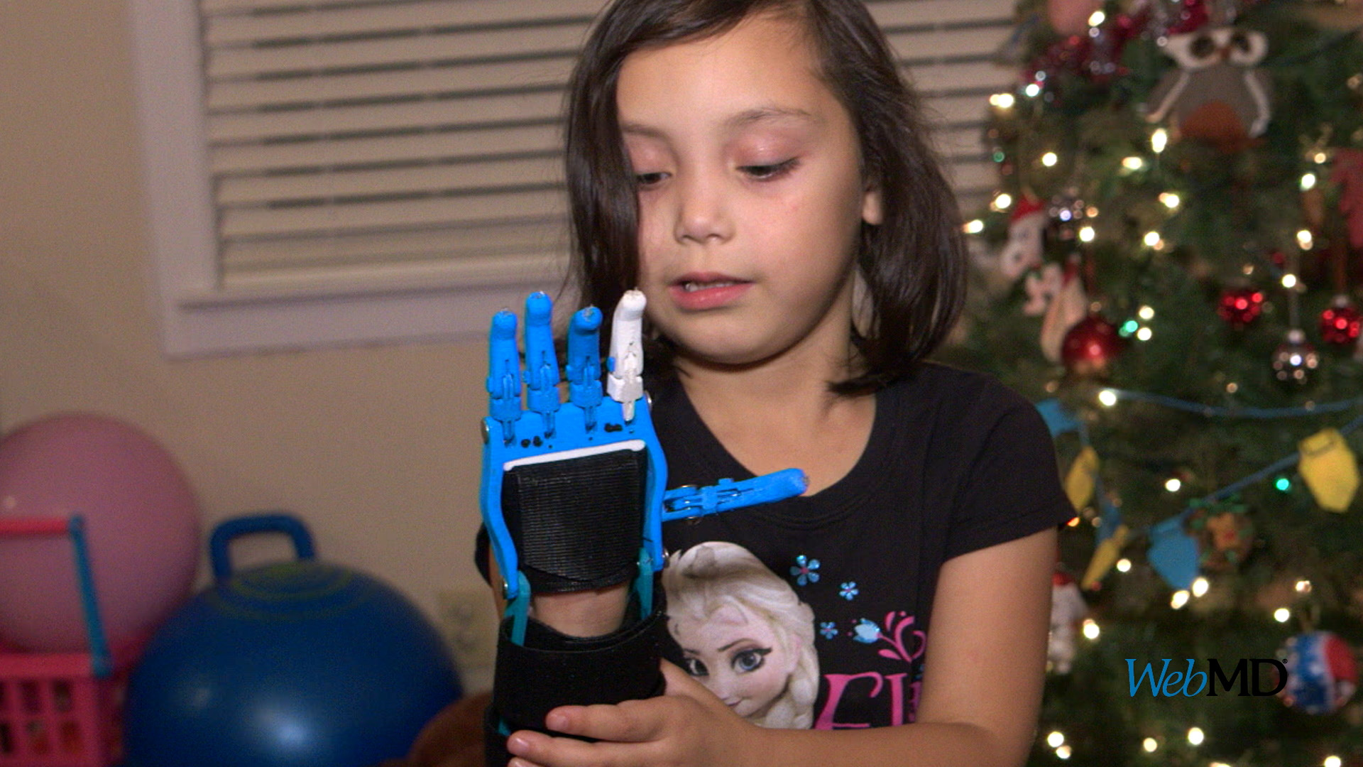 With 3-D Printing, Ariah receives prosthetic hand