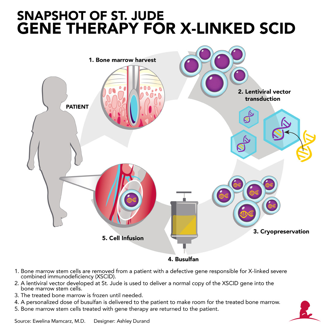 Because more than 80 percent of XSCID patients do not have a matched sibling donor, St. Jude researchers have re-engineered a lentivirus to function as a vector to ferry a normal copy of IL2RG into the patients’ hematopoietic stem cells.