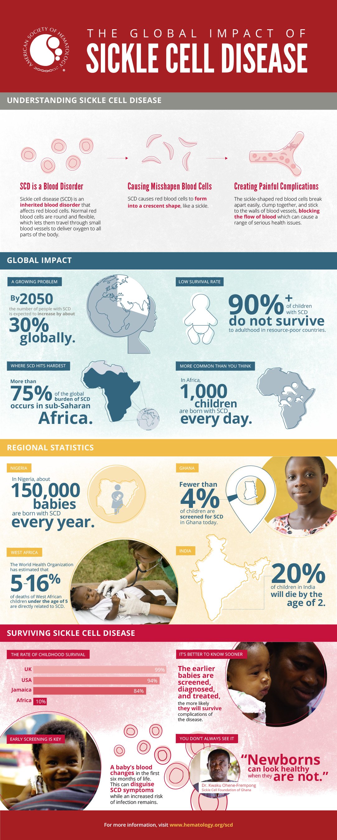 The Global Impact of SCD Infographic