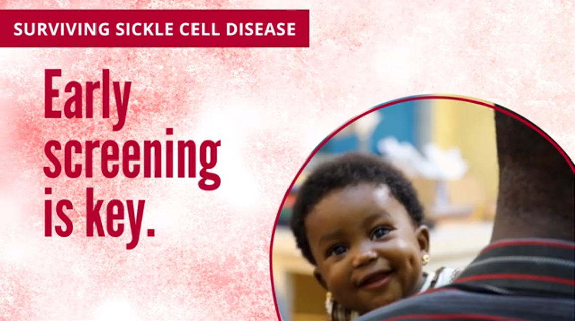 Surviving Sickle Cell Disease