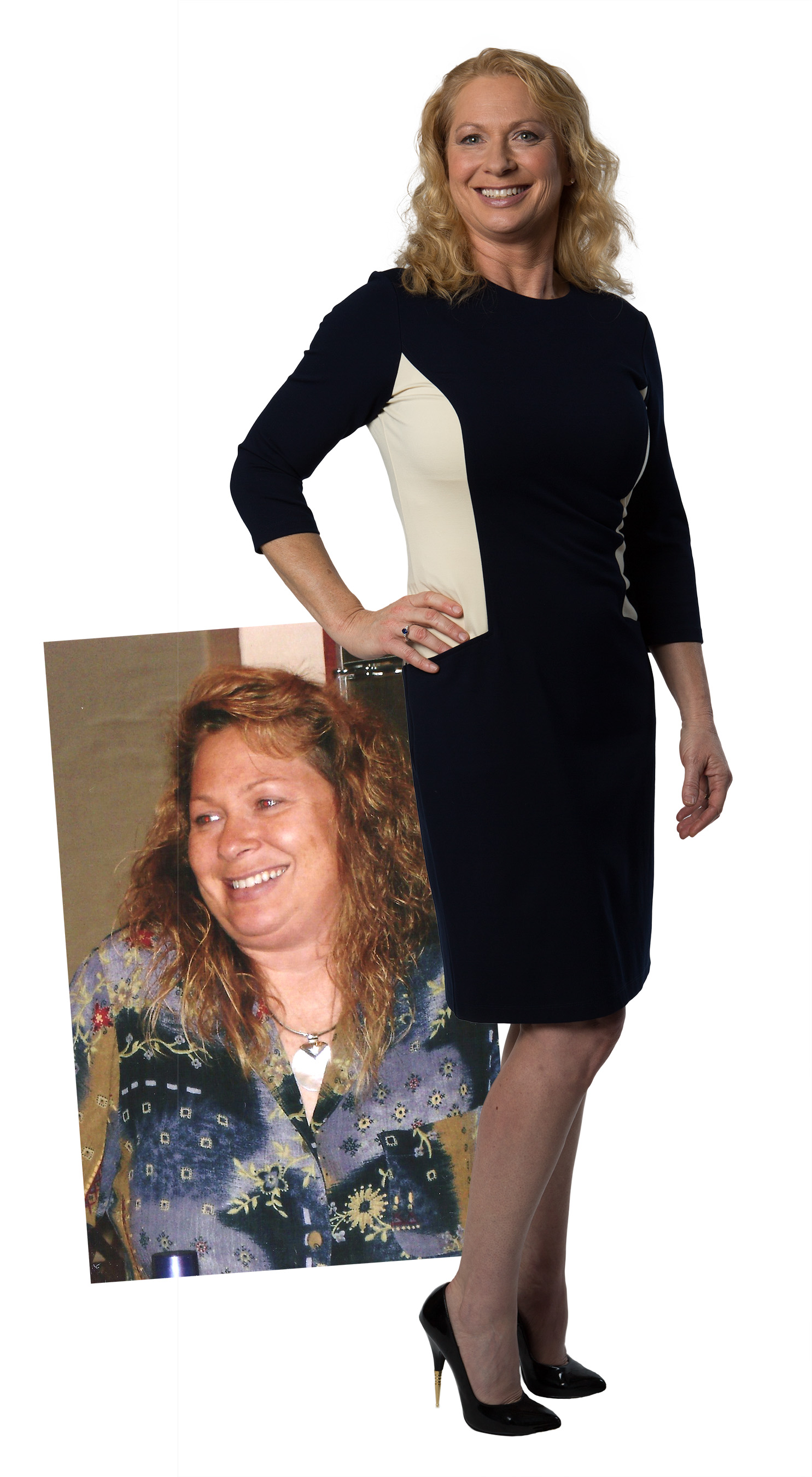 Dr. Julie Before & After Photos