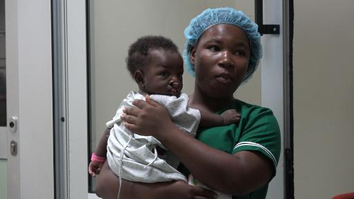 A young African woman holding a baby with a cleft palate.