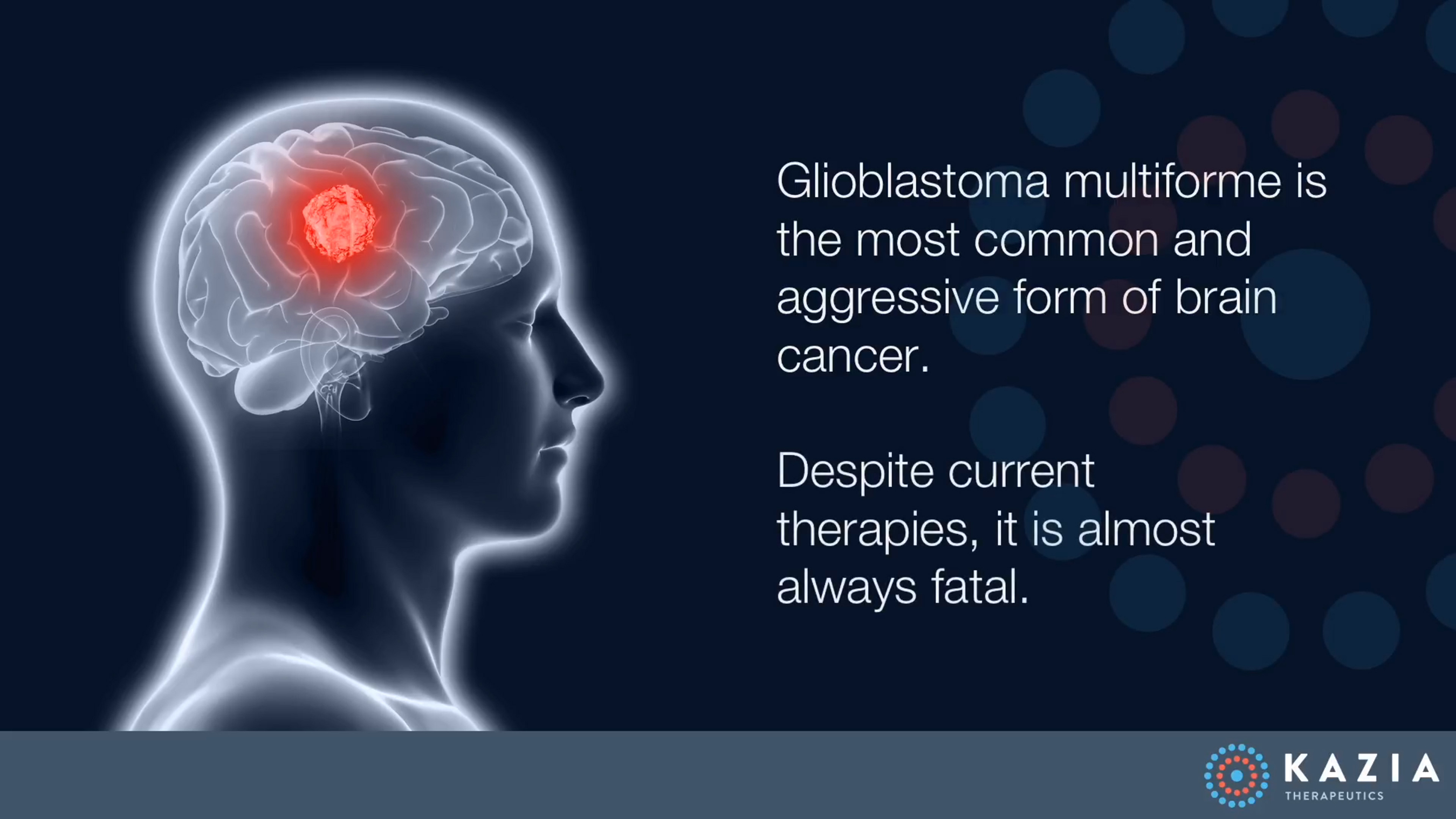 Despite current therapies, glioblastoma is almost always fatal