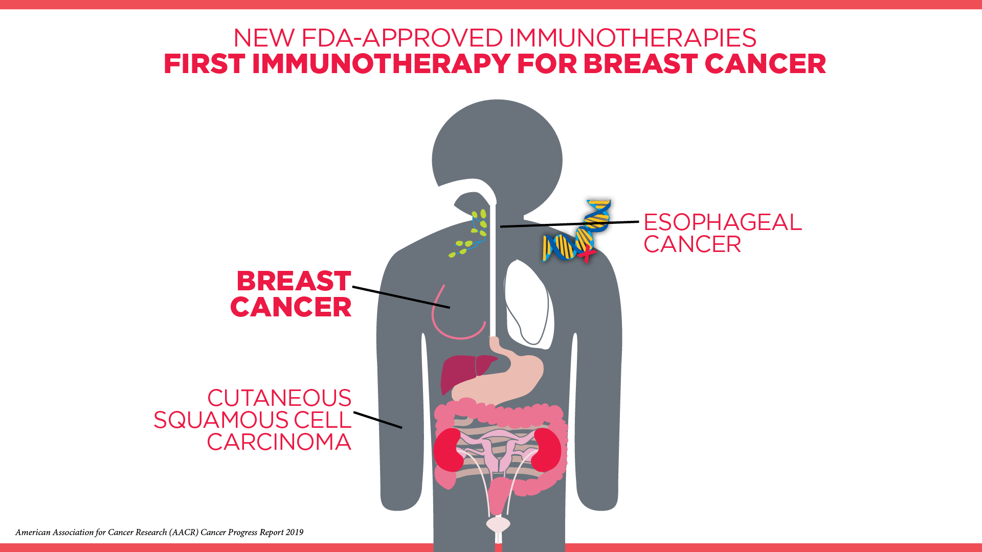 This year, the FDA approved the first immunotherapy to treat breast cancer