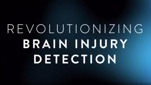 Play Video: TBI Education Animation Video
