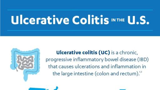 Ulcerative Colitis in the US Infographic