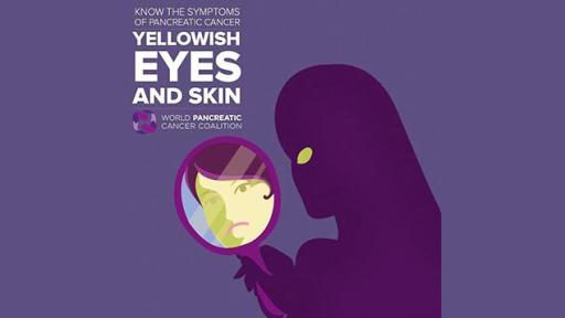 Yellowish Eyes