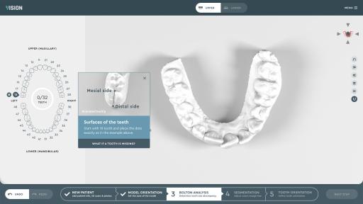 Image of lower jaw in a SoftSmile Software computer program
