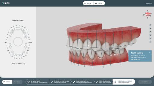 SoftSmile Software: Tooth Orientation jaw and gums