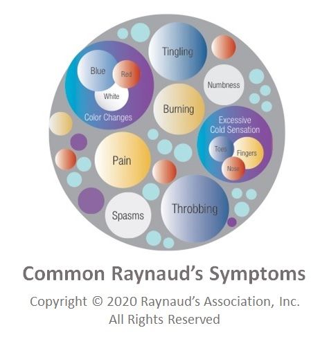 Common Raynaud's Symptoms