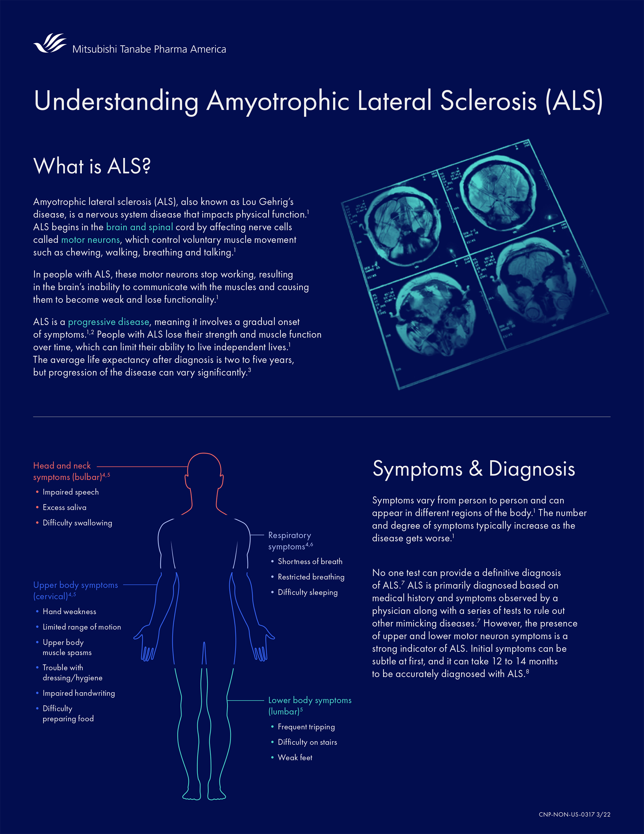 ALS Fact Sheet