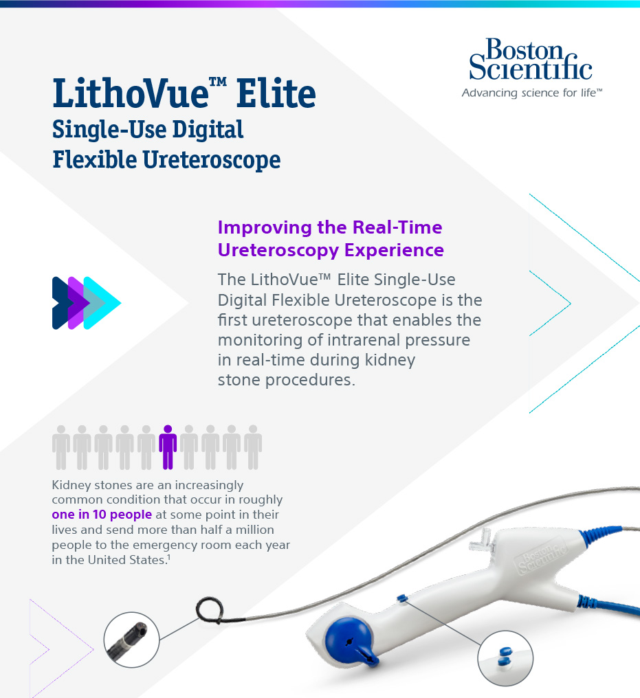 LithoVue™ Elite System Fact Sheet