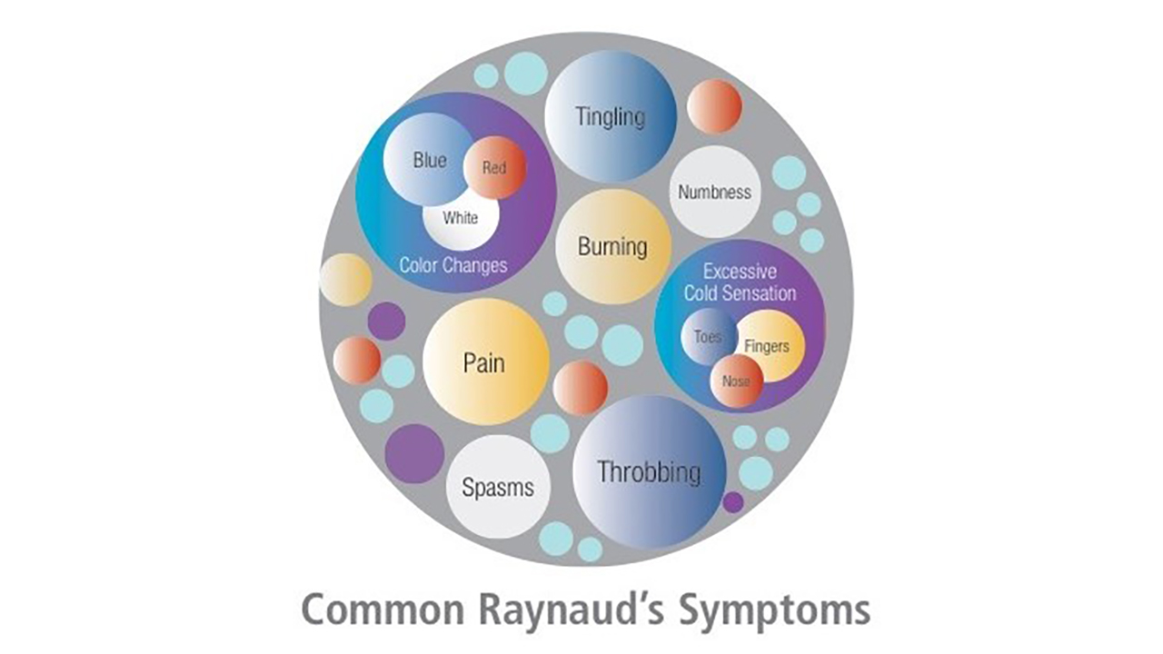Common Raynaud’s Symptoms