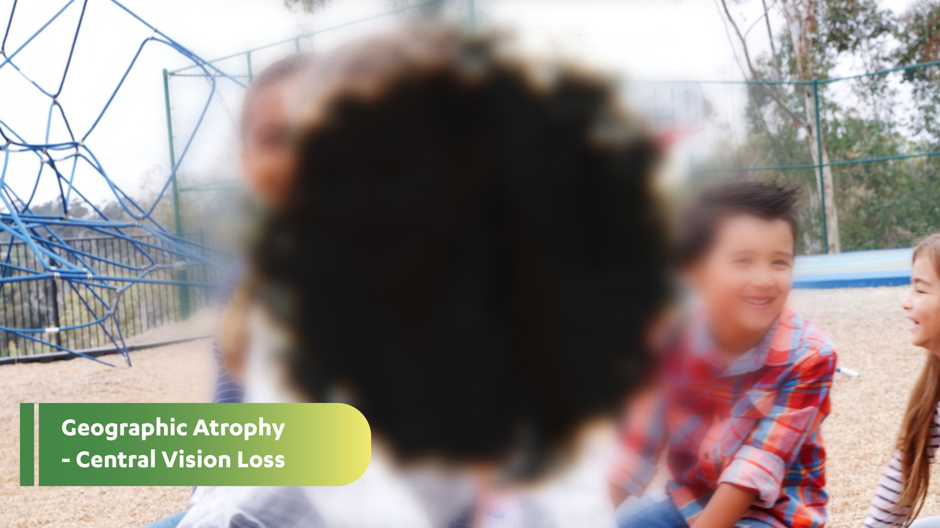 Geographic Atrophy - Central Vision Loss: Photo of young girl in a gray checkered shirt smiling with other children on a playground. The center of the image is completely dark so you can no longer see the girl's face, showing central vision loss.