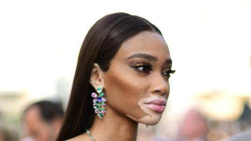 Image of Winnie Harlow drinking a glass of Perrier-Jouët at AmfAR